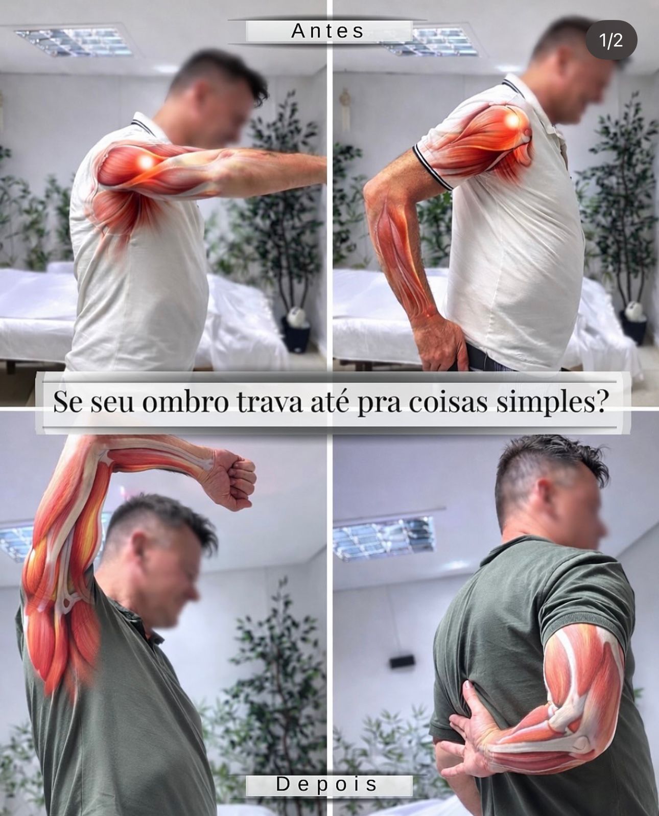 Resultado 1 - método Strasser