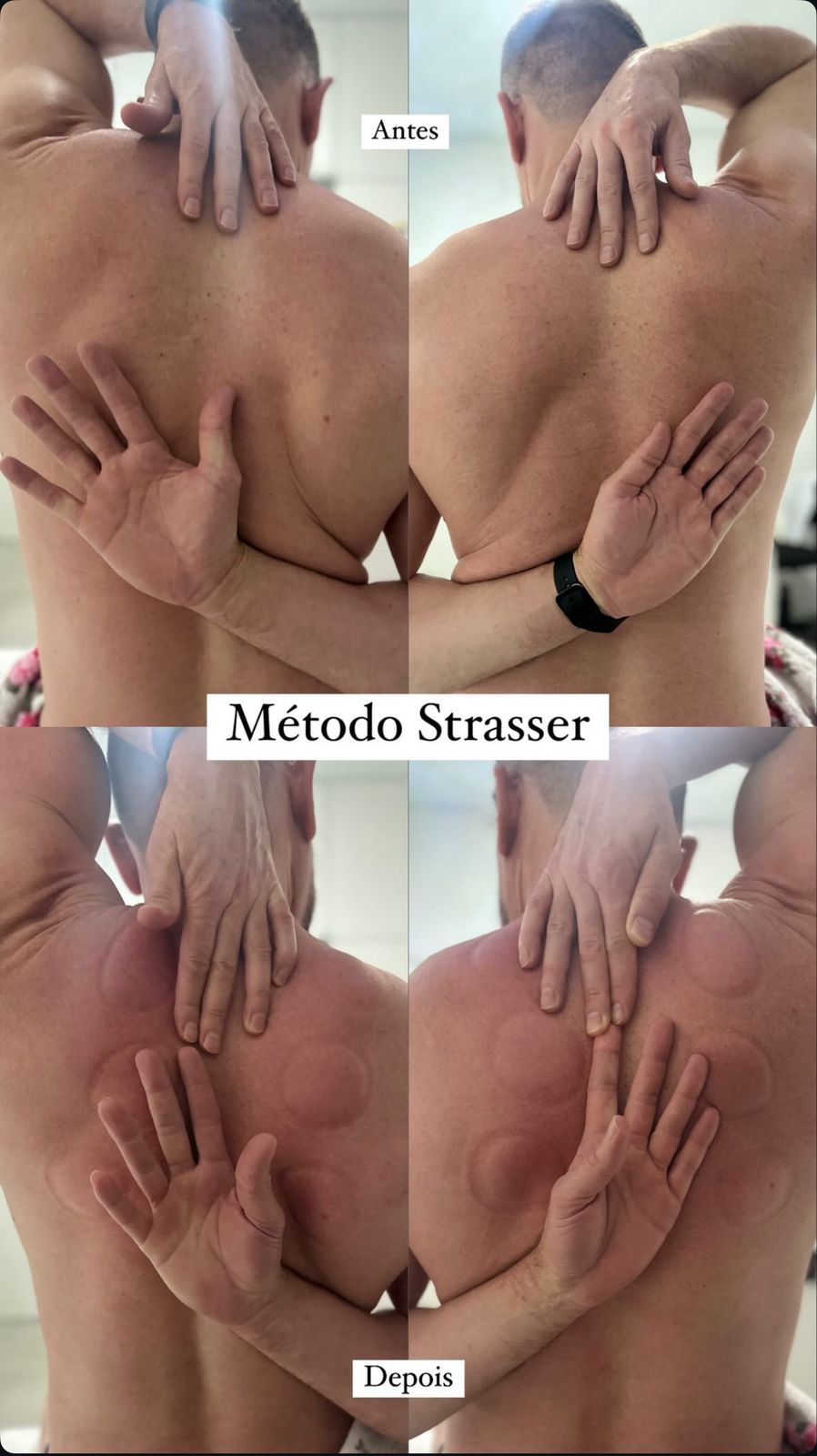 Resultado 6 - método Strasser